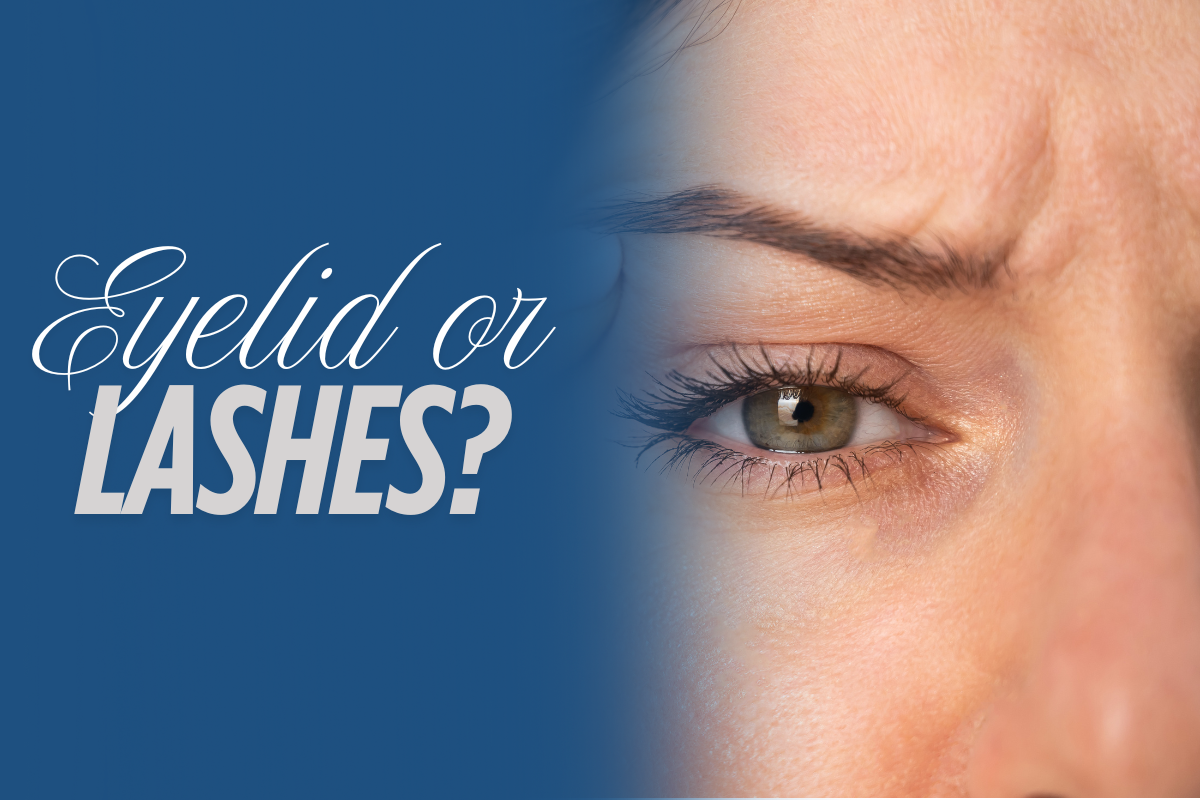Do you put lash glue on your eyelid or lashes?